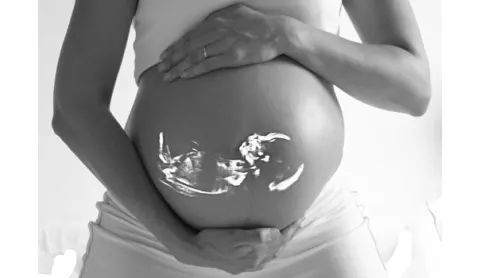 ZN: digitale gegevensuitwisseling rond geboortezorg via ‘Babyconnect’ is belangrijke stap in zorgvernieuwing